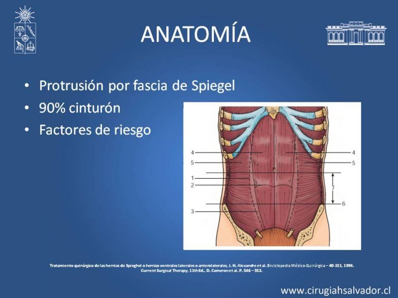 Diapositiva 3 de Hernia Spiegel