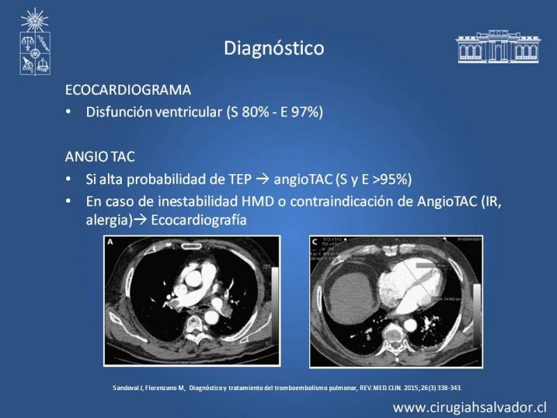 Diapositiva 16 de TEP Masivo: Diagnóstico y manejo