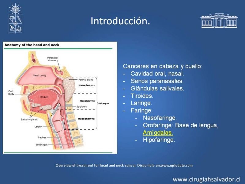 Diapositiva 1 de Cáncer de amígdala