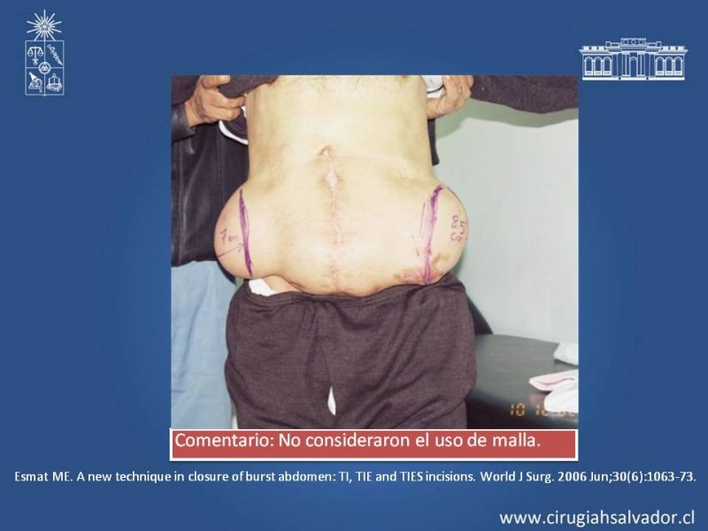 Diapositiva 41 de Evisceración