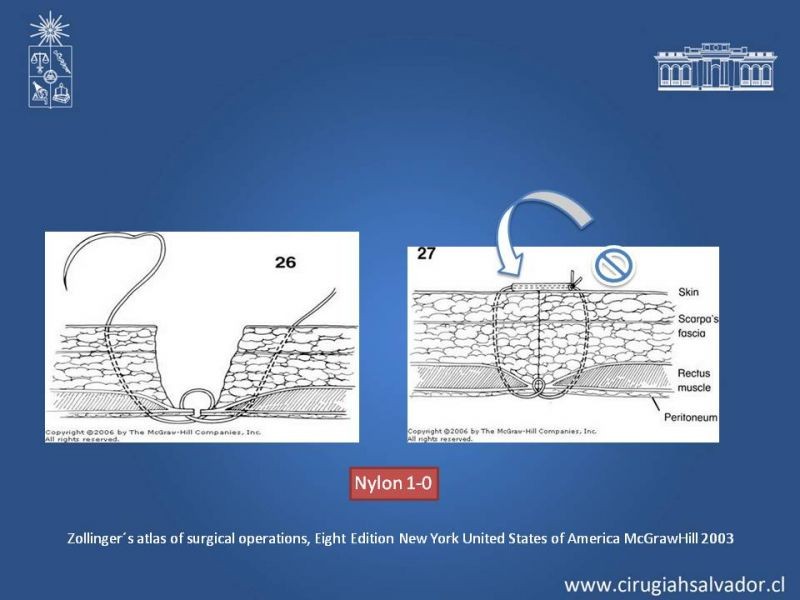 Diapositiva 24 de Evisceración