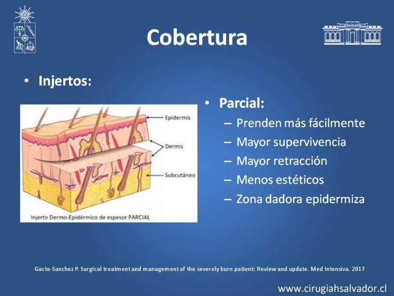 Diapositiva 21 de Manejo Quirúrgico del Gran Quemado