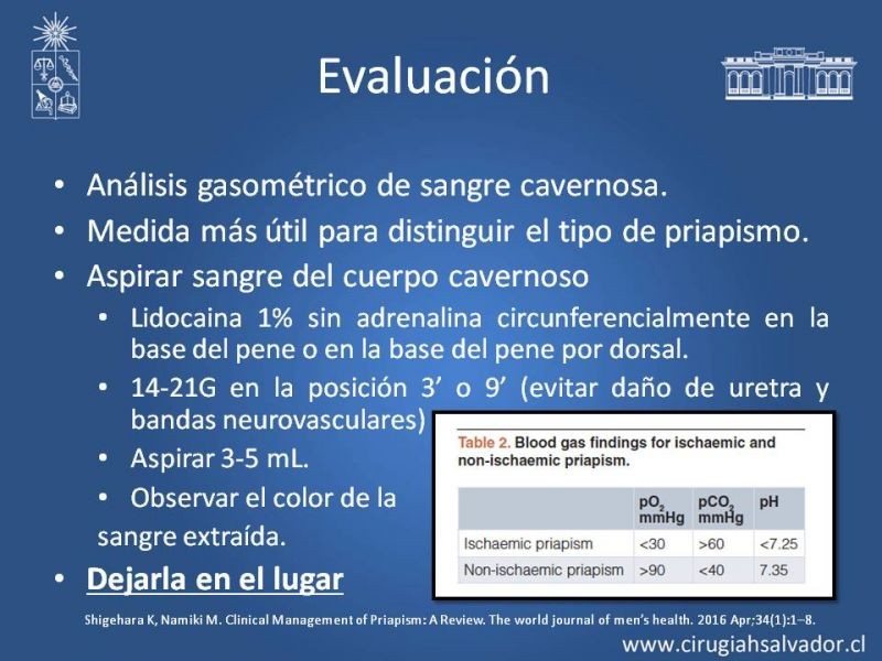 Diapositiva 13 de Priapismo