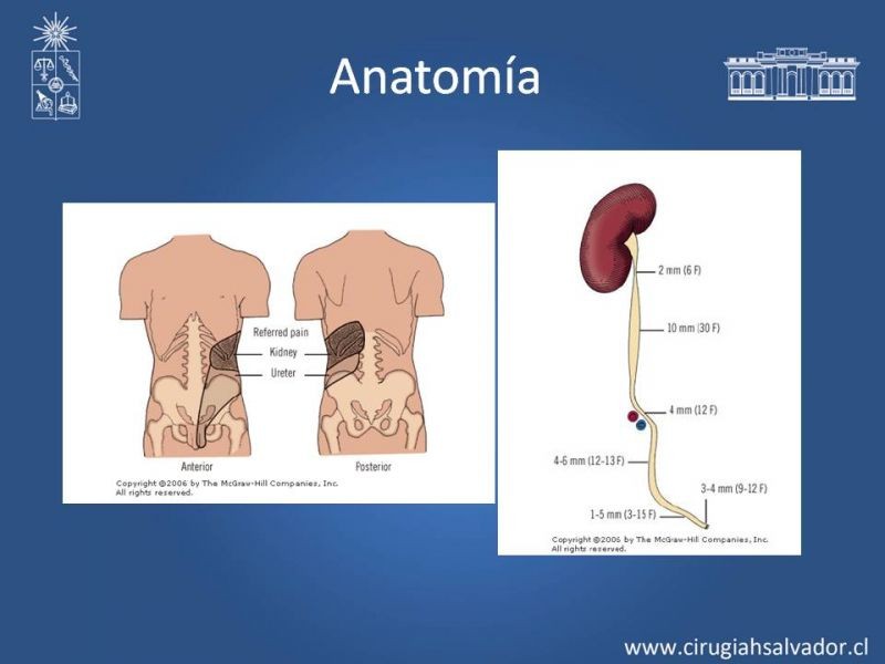 Diapositiva 9 de Urolitiasis: Manejo en Urgencias