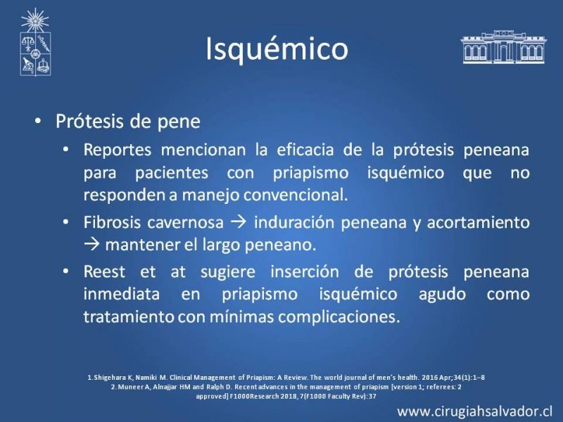 Diapositiva 30 de Priapismo