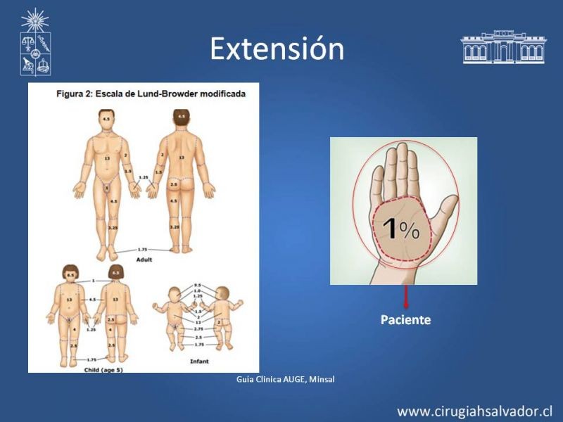 Diapositiva 5 de Manejo Quirúrgico del Gran Quemado