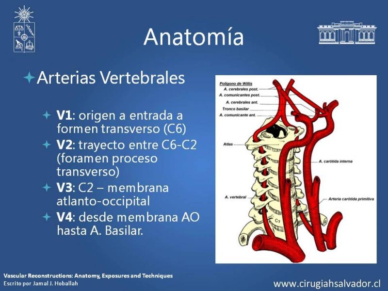 Diapositiva 9 de Anatomía Quirúrgica y Accesos de Carótida, vertebrales y subclavia
