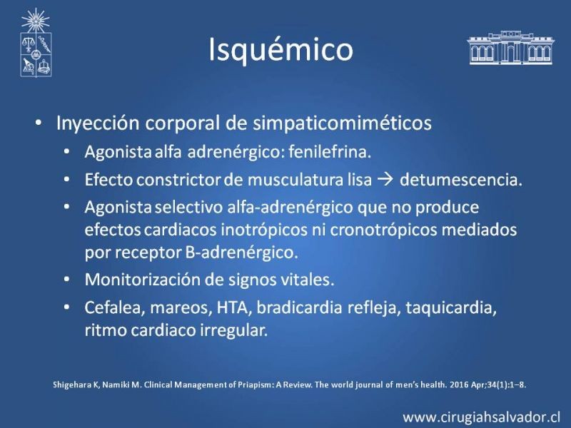 Diapositiva 21 de Priapismo