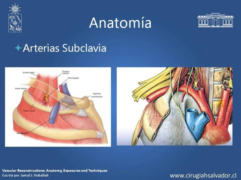Diapositiva 8 de Anatomía Quirúrgica y Accesos de Carótida, vertebrales y subclavia