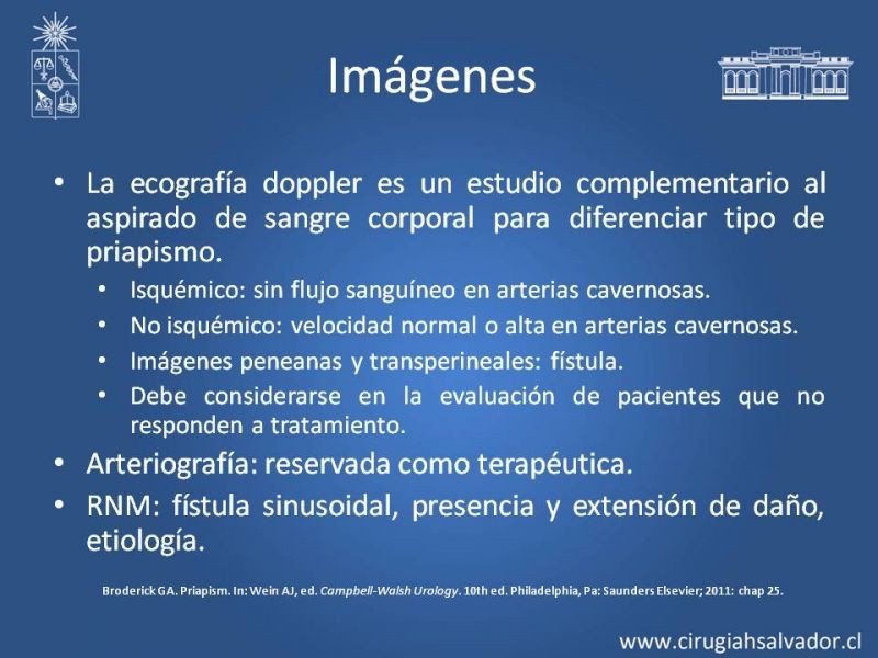 Diapositiva 14 de Priapismo