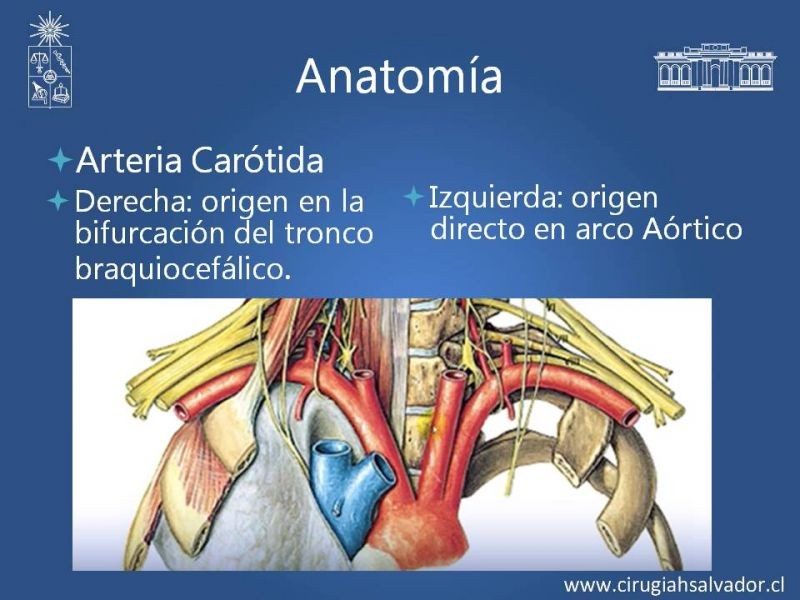 Diapositiva 5 de Anatomía Quirúrgica y Accesos de Carótida, vertebrales y subclavia
