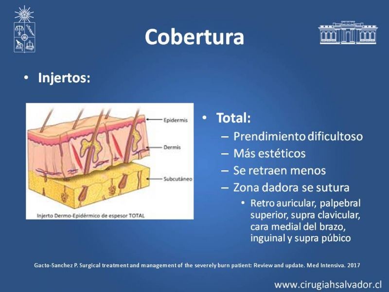 Diapositiva 24 de Manejo Quirúrgico del Gran Quemado