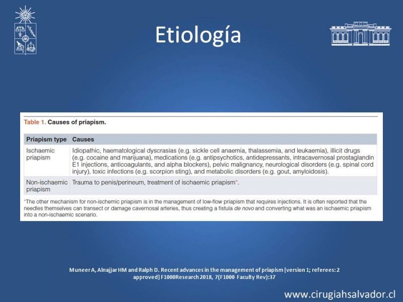 Diapositiva 9 de Priapismo