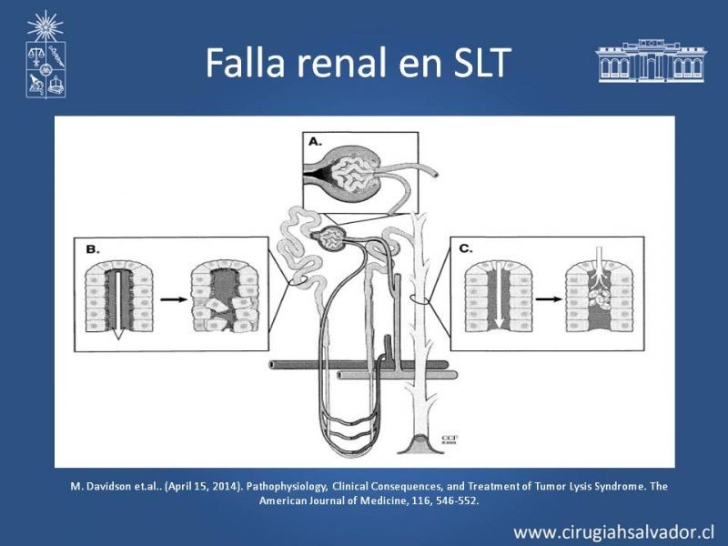 Diapositiva 13 de Síndrome de Lisis Tumoral