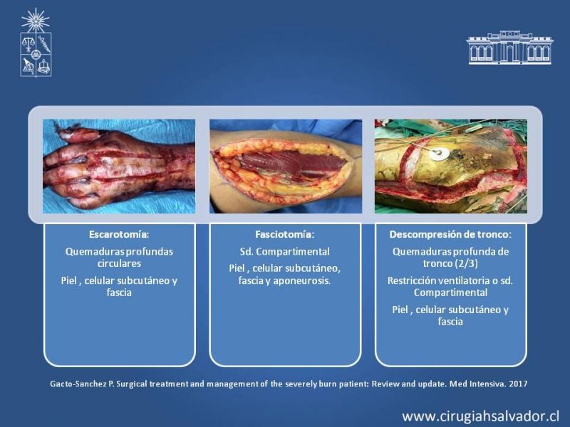 Diapositiva 12 de Manejo Quirúrgico del Gran Quemado