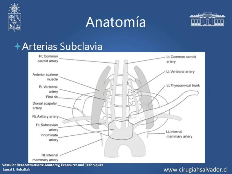 Diapositiva 7 de Anatomía Quirúrgica y Accesos de Carótida, vertebrales y subclavia