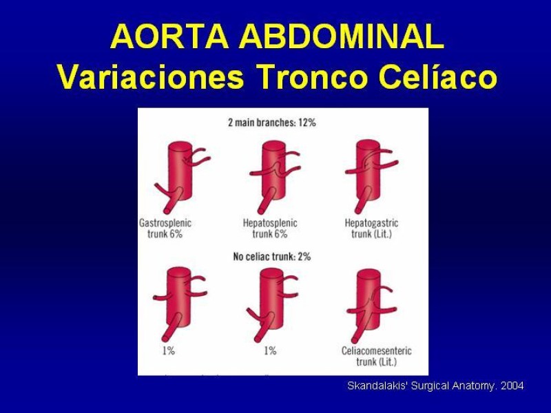 Diapositiva 17 de Anatomía grandes vasos abdominales