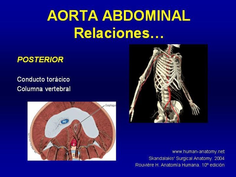Diapositiva 10 de Anatomía grandes vasos abdominales