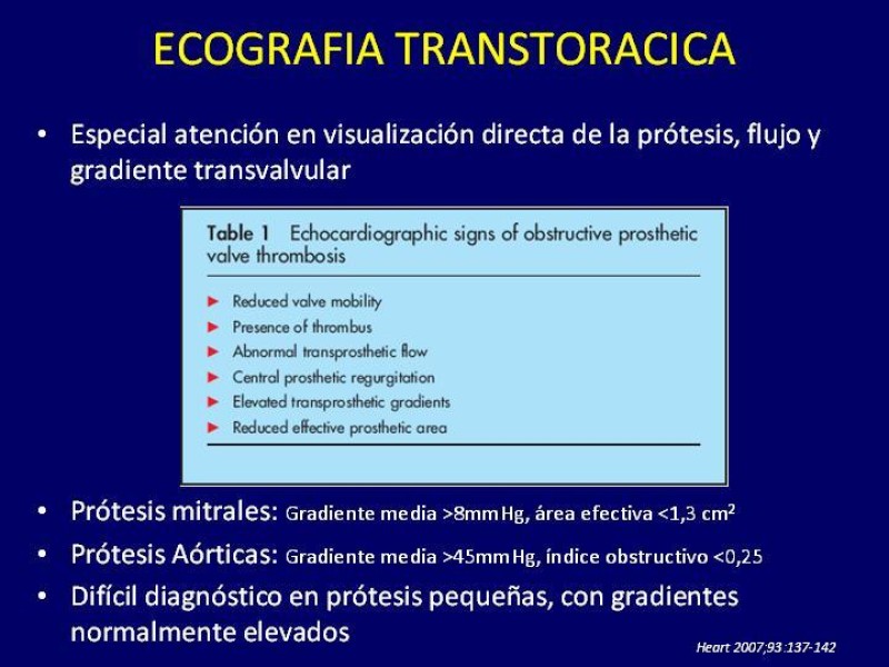 Diapositiva 17 de Trombosis de válvulas protésicas