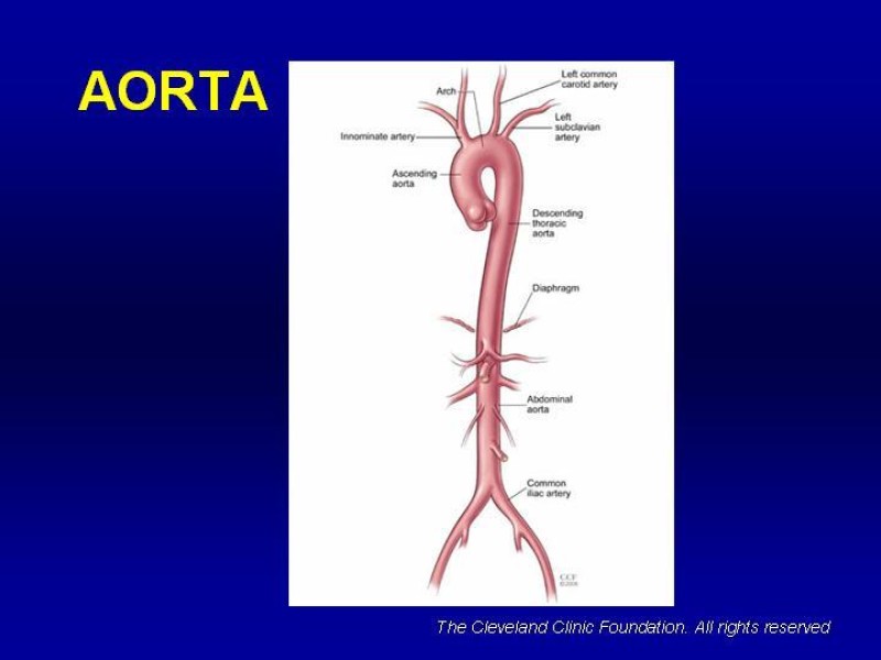Diapositiva 1 de Anatomía grandes vasos abdominales