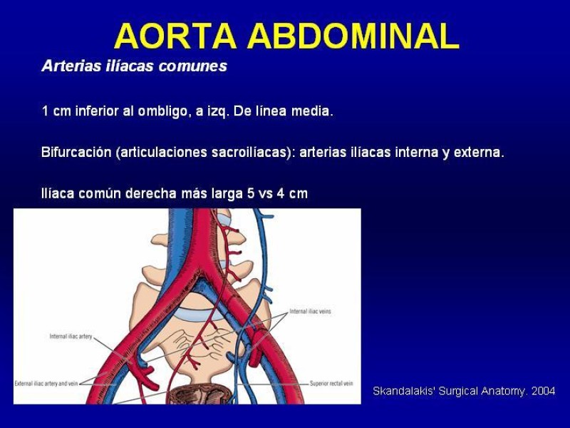 Diapositiva 7 de Anatomía grandes vasos abdominales