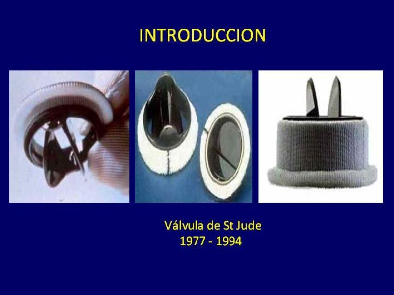Diapositiva 6 de Trombosis de válvulas protésicas