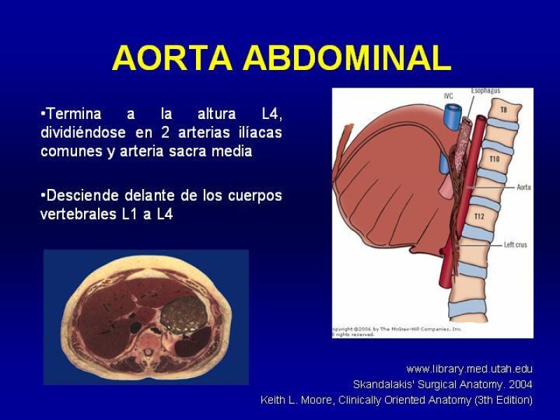 Diapositiva 4 de Anatomía grandes vasos abdominales