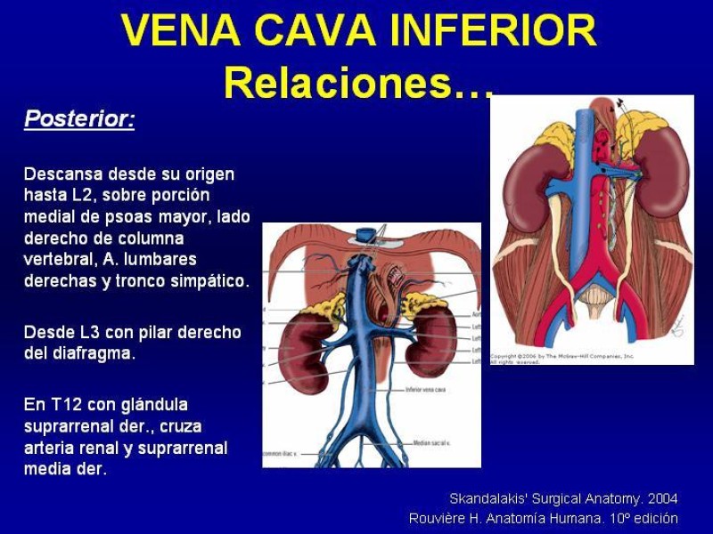 Diapositiva 11 de Anatomía grandes vasos abdominales 2