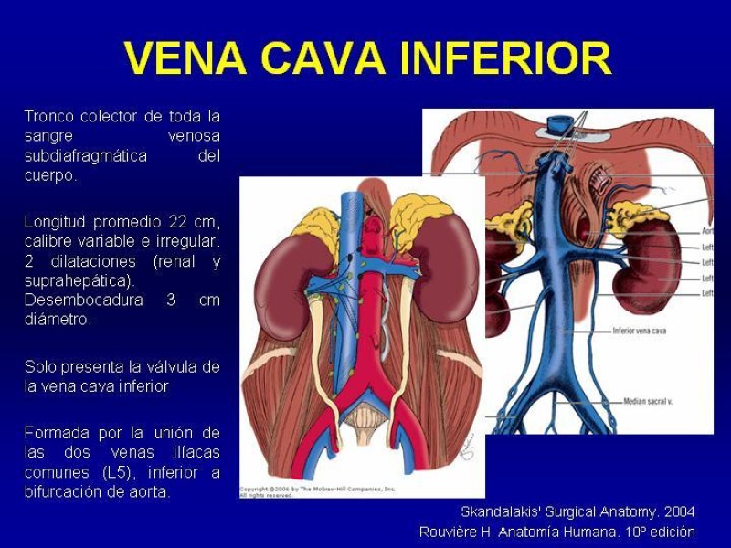 Diapositiva 9 de Anatomía grandes vasos abdominales 2