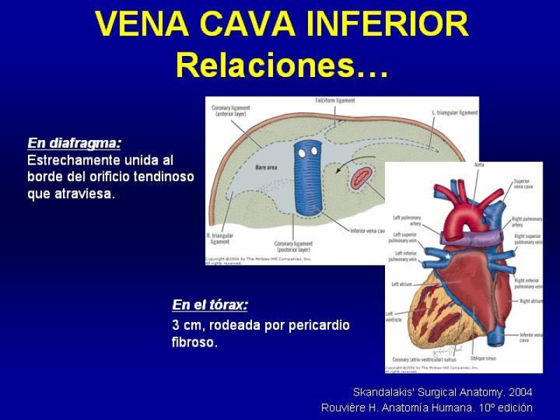 Diapositiva 14 de Anatomía grandes vasos abdominales 2