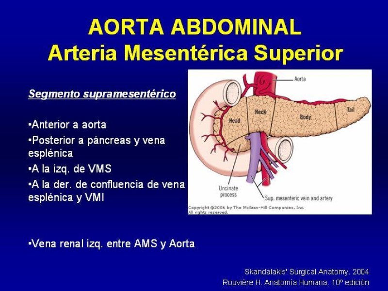 Diapositiva 19 de Anatomía grandes vasos abdominales