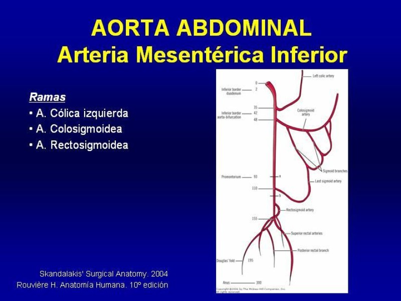 Diapositiva 1 de Anatomía grandes vasos abdominales 2