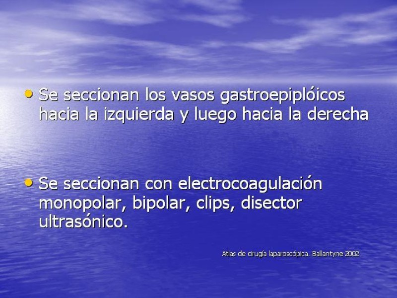 Diapositiva 4 de Gastrectomía Laparoscópica Pt. II