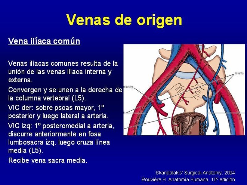 Diapositiva 8 de Anatomía grandes vasos abdominales 2