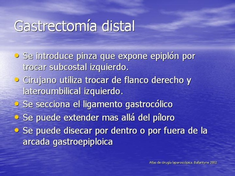 Diapositiva 3 de Gastrectomía Laparoscópica Pt. II