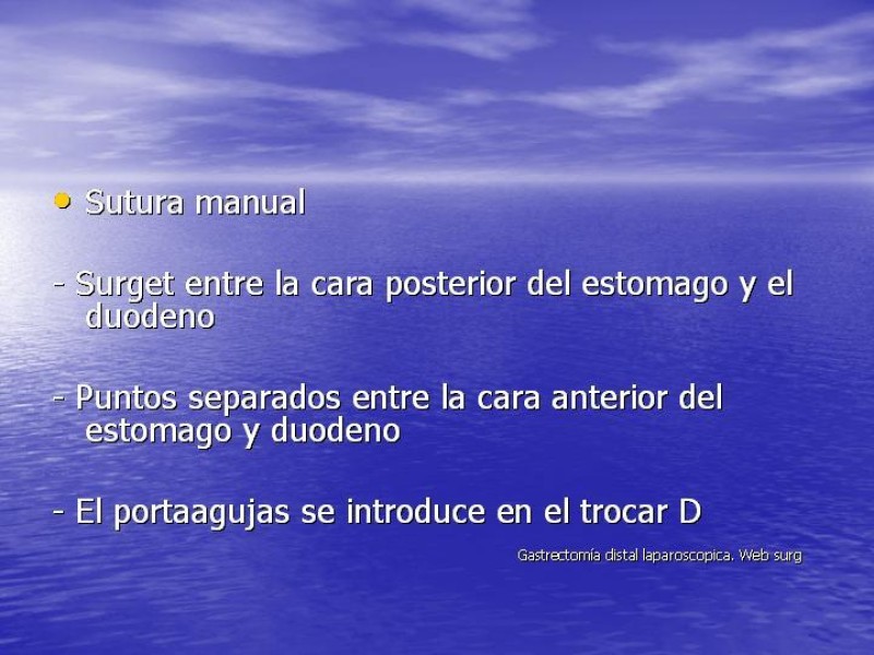 Diapositiva 16 de Gastrectomía Laparoscópica Pt. II