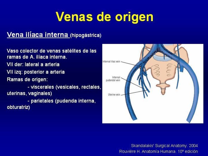Diapositiva 7 de Anatomía grandes vasos abdominales 2