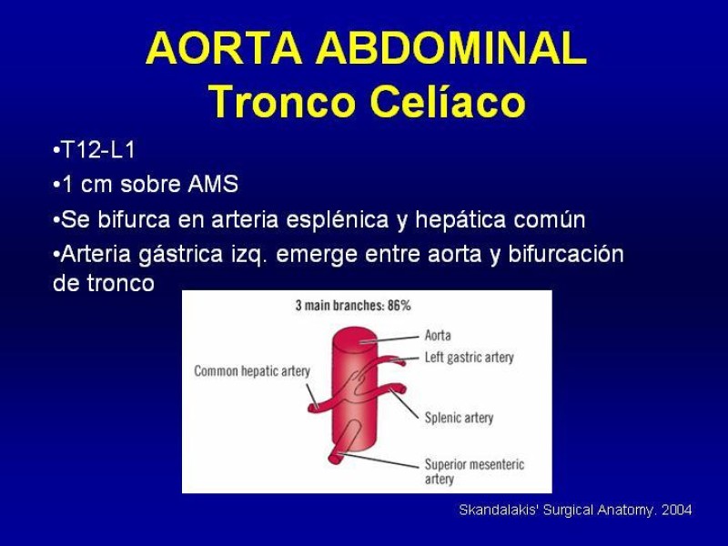Diapositiva 16 de Anatomía grandes vasos abdominales