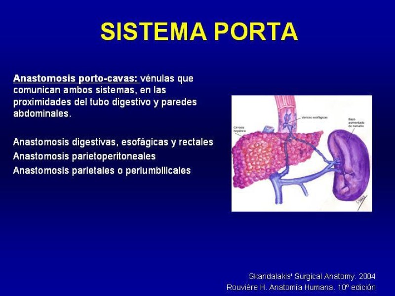 Diapositiva 23 de Anatomía grandes vasos abdominales 2