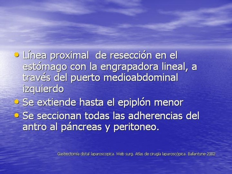 Diapositiva 10 de Gastrectomía Laparoscópica Pt. II