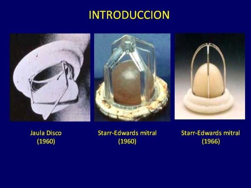 Diapositiva 3 de Trombosis de válvulas protésicas