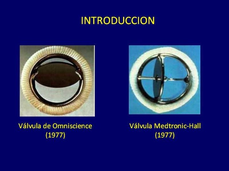 Diapositiva 5 de Trombosis de válvulas protésicas