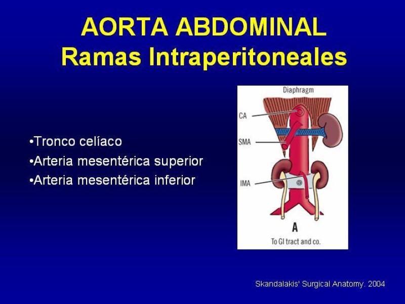Diapositiva 13 de Anatomía grandes vasos abdominales