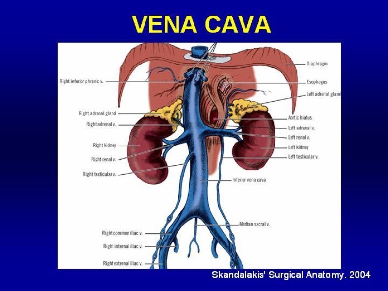 Diapositiva 4 de Anatomía grandes vasos abdominales 2