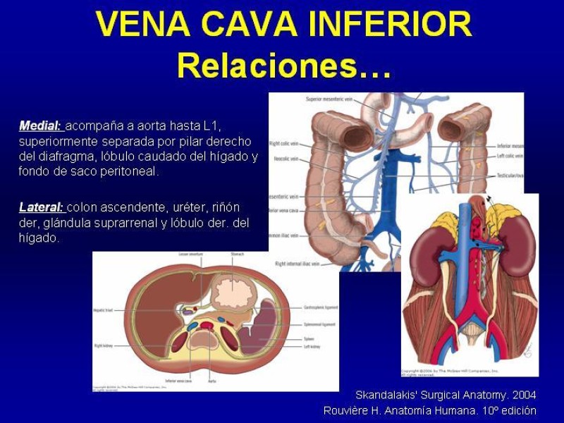 Diapositiva 13 de Anatomía grandes vasos abdominales 2