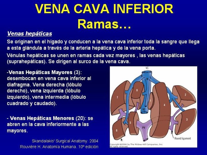 Diapositiva 15 de Anatomía grandes vasos abdominales 2