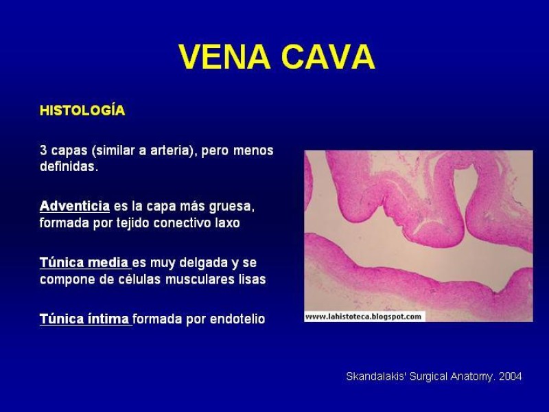 Diapositiva 5 de Anatomía grandes vasos abdominales 2