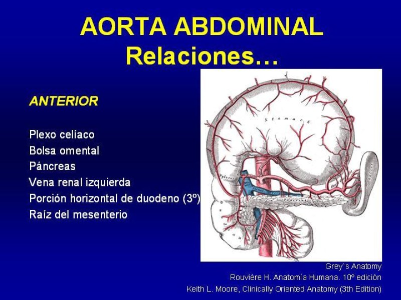 Diapositiva 8 de Anatomía grandes vasos abdominales