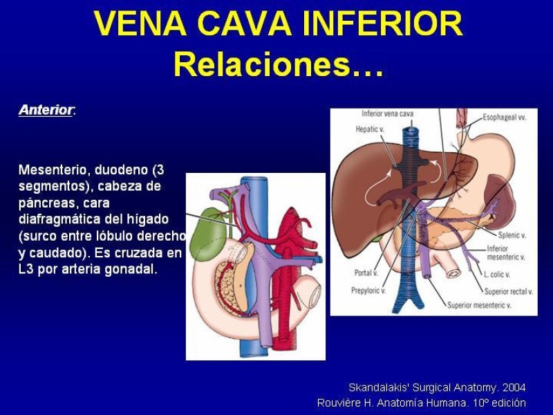 Diapositiva 12 de Anatomía grandes vasos abdominales 2