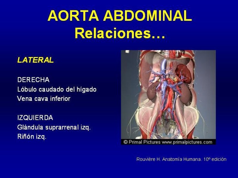 Diapositiva 11 de Anatomía grandes vasos abdominales